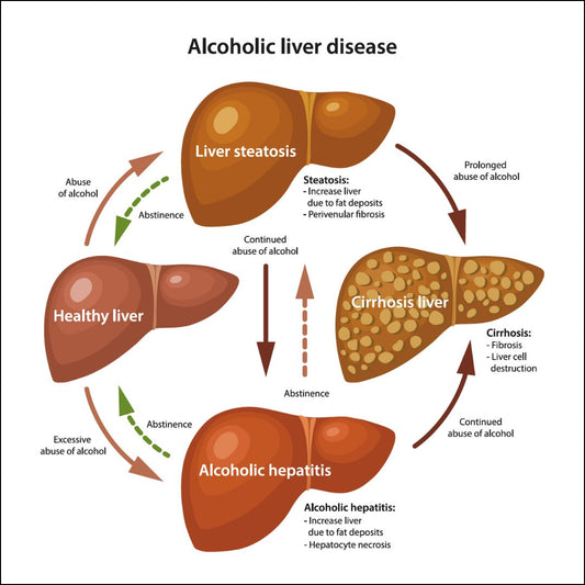 Liver Health in the Age of Supplements, Alcohol & Junk Food