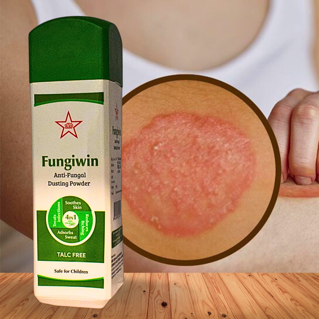 Powder For Infection FUNGIWIN POWDER ( FOR- FUNGAL INFECTION) (By - By- SKM SIDDHA AND AYUR ...