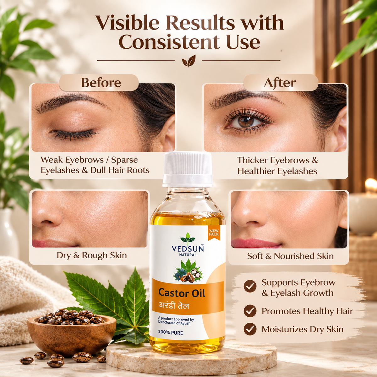 Vedsun Natural Castor Oil – 100% Pure & Cold Pressed for Hair & Skin Care 100ml